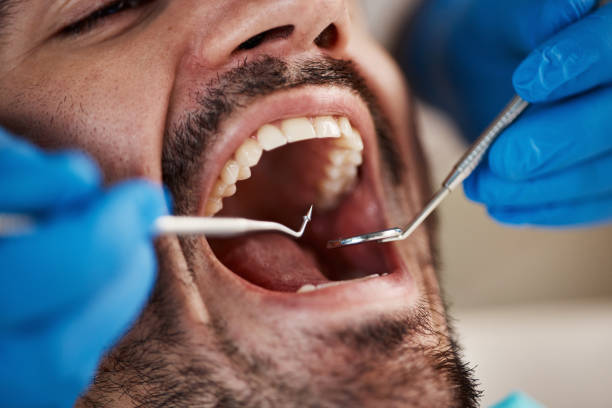 Best 24-Hour Emergency Dentist in Takoma Park, MD