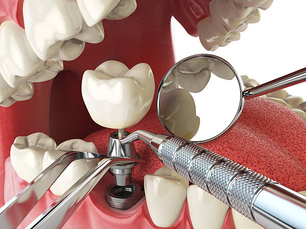 Best Mobile Emergency Dentist in Takoma Park, MD